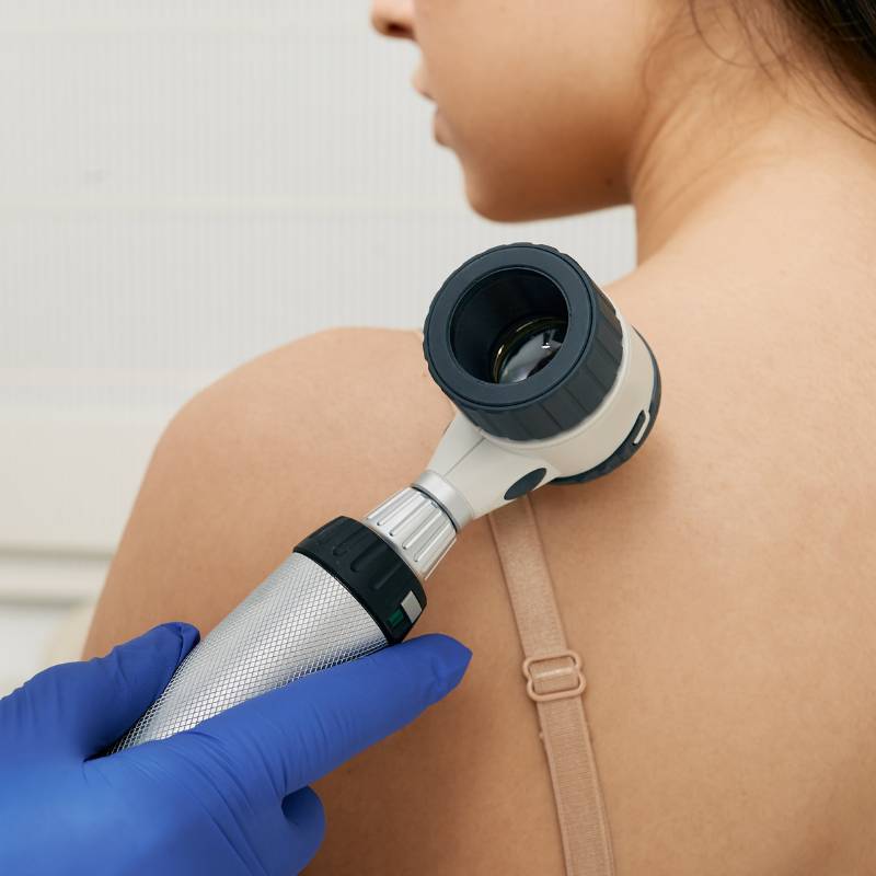Dermatologista tratamento cancer de pele